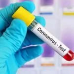 Corona PCR Fake Test