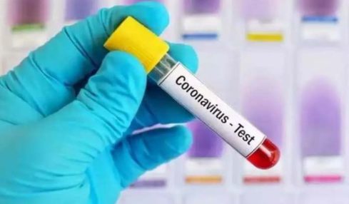 Corona PCR Fake Test