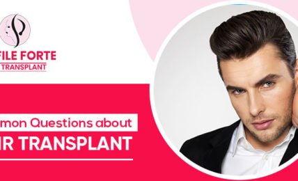 Common-Questions-about-hair-transplant